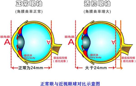 近视原理